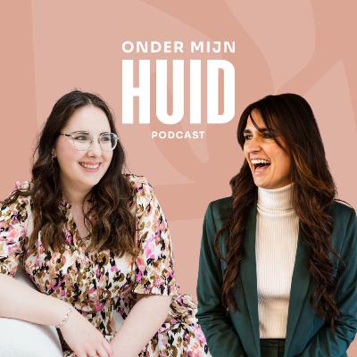 OMH #5. Kimberly Dierickx over hormonale acne, zelfvertrouwen en haar missie om anderen met haarverlies te helpen OMH #5. Kimberly Dierickx over hormonale acne, zelfvertrouwen en haar missie om anderen met haarverlies te helpen