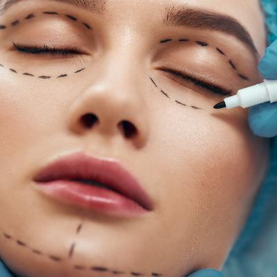 Cicatrização da Pálpebra - Plástica Ocular | Dr. Fábio Leonardo