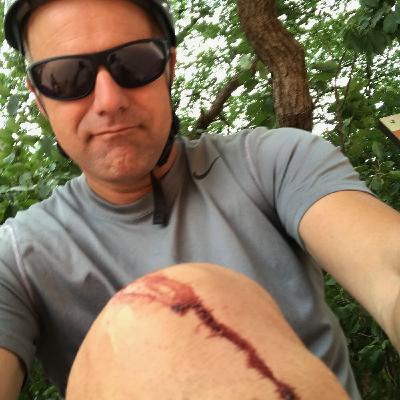 EP 110 Health Topic (Bonus) Why you should not ICE injuries! EP 110 Health Topic (Bonus) Why you should not ICE injuries!