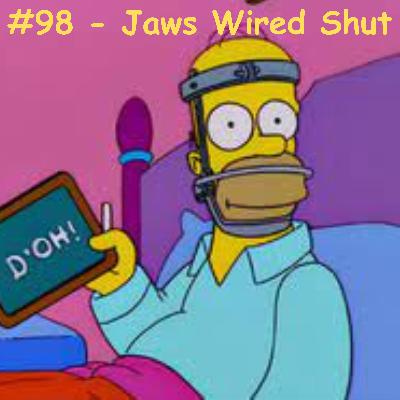 Episode 4 - #98- Jaws Wired Shut S13E9