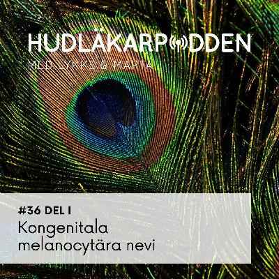#36 del 1 - Kongenitala melanocytära nevi