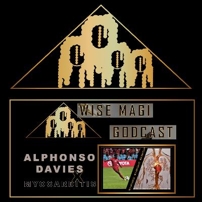 Alphonso Davies sidelined due to Myocarditis | 💉 Alphonso Davies sidelined due to Myocarditis | 💉