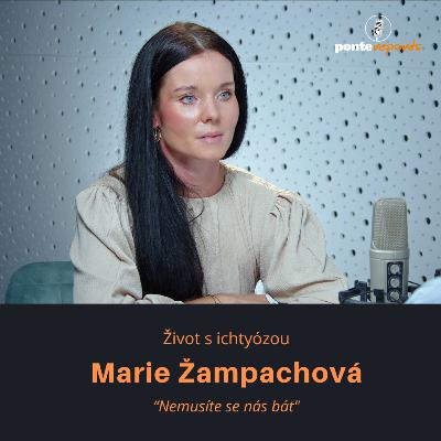 Marie Žampachová – život s ichtyózou: Nemusíte se nás bát