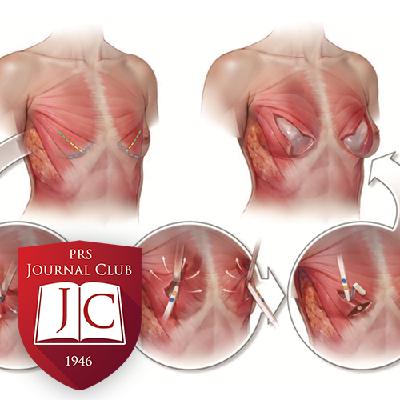"Bimuscular Flap Technique" with Bradley Calobrace, MD - Dec. 2025 Journal Club