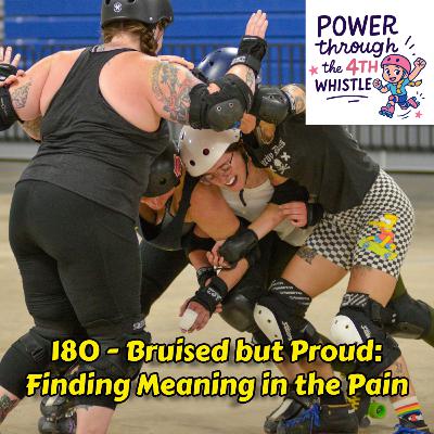170 - Bruised but Proud: Finding Meaning in the Pain
