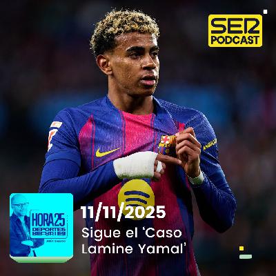 Hora 25 Deportes | Sigue el ‘Caso Lamine Yamal’ Hora 25 Deportes | Sigue el ‘Caso Lamine Yamal’