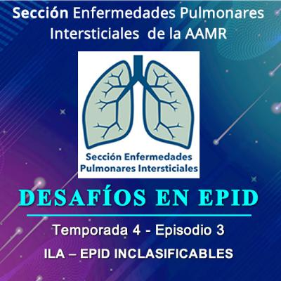 DESAFÍOS EN EPID - Temporada 4 - Episodio 3 - ILA – EPID INCLASIFICABLES