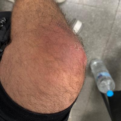 COMUNICADO - HOSPITALIZACION