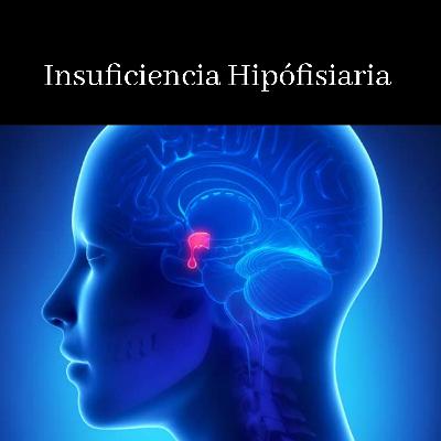 Episodio #14 Insuficiencia Hipófisiaria