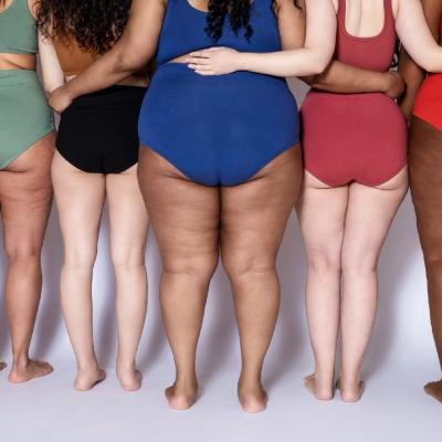 Lipedema: Millions of Women Suffer in Silence