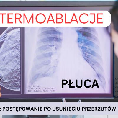 Odcinek 151. Termoablacje jako metoda usuwania przerzutów do płuc. Kiedy i u kogo ma sens.