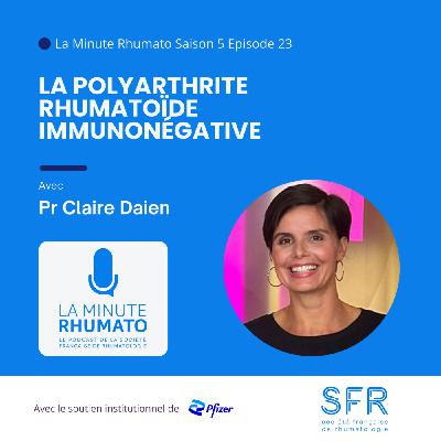La polyarthrite rhumatoïde immunonégative