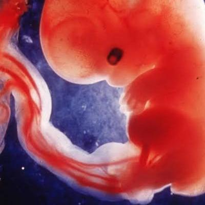 El aborto ¿Qué dice la Biblia?