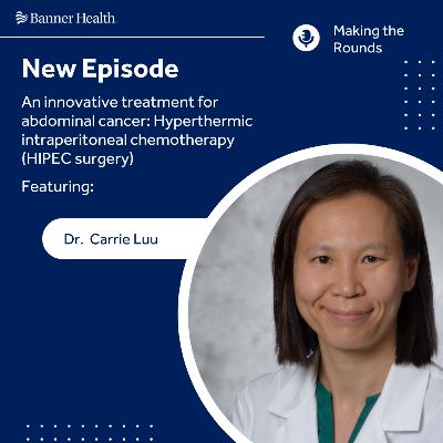 An innovative treatment for abdominal cancer: Hyperthermic intraperitoneal chemotherapy (HIPEC surgery)