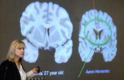 How to prevent CTE on and off the football field