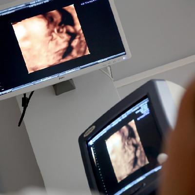 Medicina genómica de mano de Navarrabiomed ante problemas de fertilidad