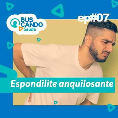 Ep#07 - Espondilite anquilosante