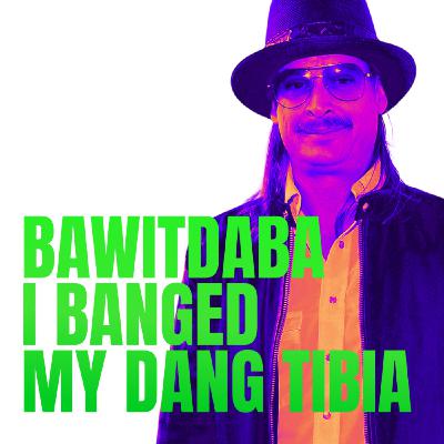 Bawitdaba I Banged My Dang Tibia