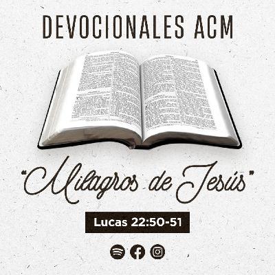 Milagros de Jesús | Lucas 22:50-51 Milagros de Jesús | Lucas 22:50-51