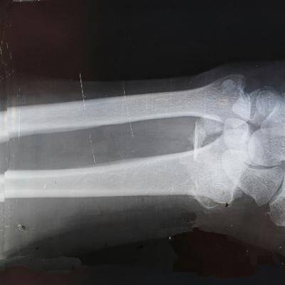 97. Healing Unseen Wounds: Bandaids Can't Fix a Broken Arm 97. Healing Unseen Wounds: Bandaids Can't Fix a Broken Arm