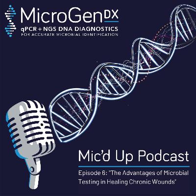The Advantages of Microbial Testing in Healing Chronic Wounds The Advantages of Microbial Testing in Healing Chronic Wounds