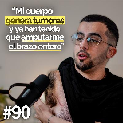 Mi Brazo Pesaba 30kg por Los Tumores que tenía - Kevin | Un Propósito #90