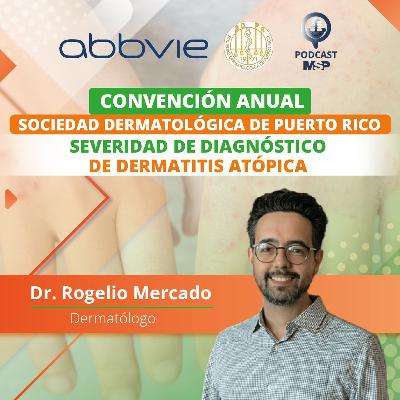 Severidad De Diagnóstico De Dermatitis Atópica Severidad De Diagnóstico De Dermatitis Atópica
