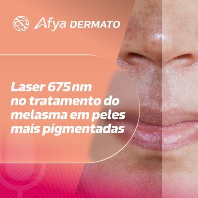 Laser 675 nm no tratamento do melasma em peles mais pigmentadas