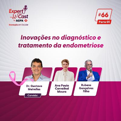 66 - Inovações no Diagnóstico e Tratamento da Endometriose ( parte 1 )