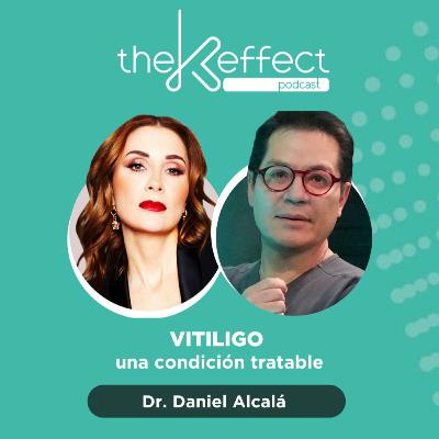 🩺 Vitiligo, una condición tratable