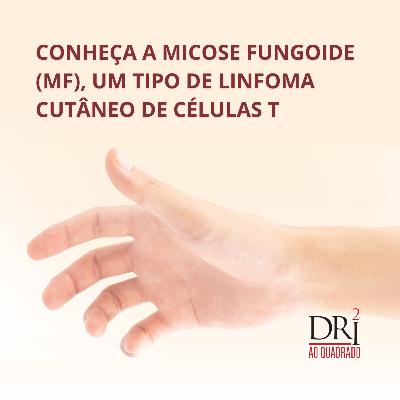 Ep. 46 - Conheça a Micose Fungoide, um tipo de linfoma cutâneo de células T