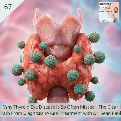 67: Why Thyroid Eye Disease Is So Often Missed - The Clear Path From Diagnosis to Real Treatment with Dr. Sean Paul 67: Why Thyroid Eye Disease Is So Often Missed - The Clear Path From Diagnosis to Real Treatment with Dr. Sean Paul