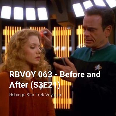 RBVOY 063 – Before and After (S3E21)