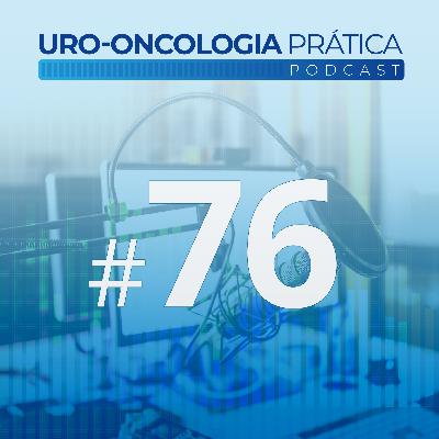 Uro-Oncologia Prática 76 - Papel do PET FDG no Seminoma Estadio I e II