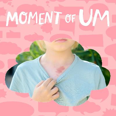 What are birthmarks? What are birthmarks?