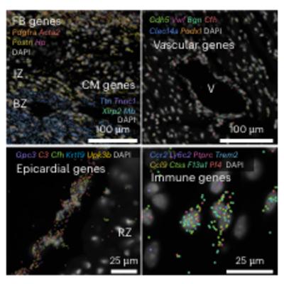 Spatiotemporal dynamics of the cardioimmune niche during lesion repair