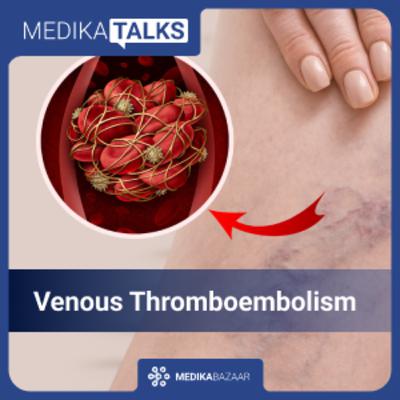 Episode 34: Know what is Venous Thromboembolism and how VTE can be treated post operative