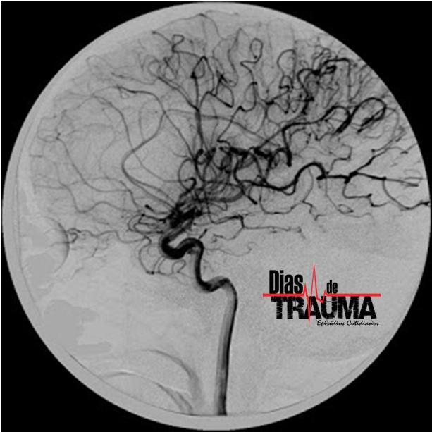 Dias de Trauma - Contraste Maldito episode artwork