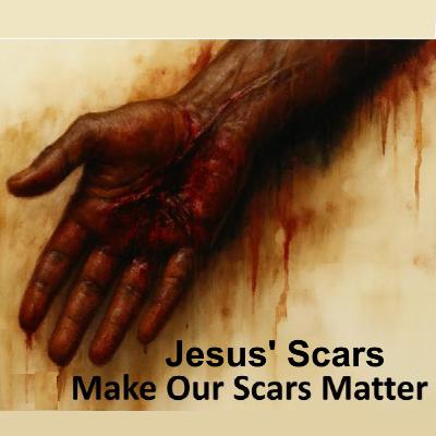 Jesus’ Scars Make Our Scars Matter - Minister George Ferguson