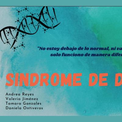 Otra forma de ver el Sindrome de Down