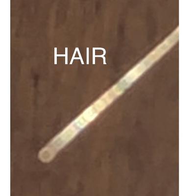 Morgellons: The Bell Tolls for Thee
