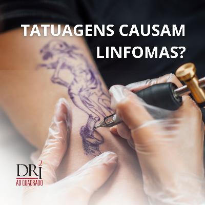 Ep. 45 - Tatuagens causam linfomas?