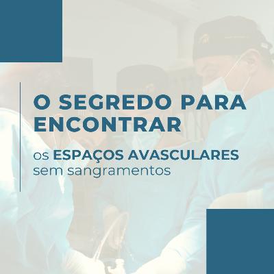 O segredo para encontrar os espaços avasculares sem sangramentos O segredo para encontrar os espaços avasculares sem sangramentos