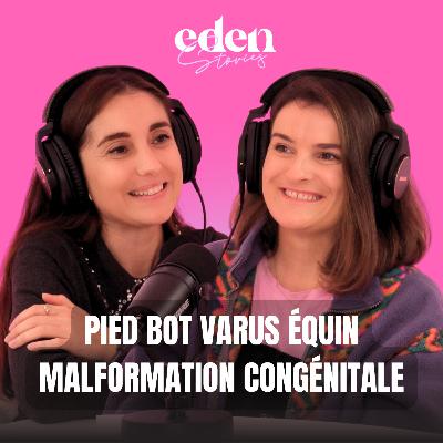 PIED BOT VARUS ÉQUIN : MALFORMATION CONGÉNITALE - Eden Stories