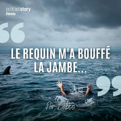 LE REQUIN M'A BOUFFÉ LA JAMBE...