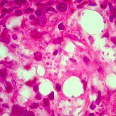 Leishmaniose Visceral Canina: como diagnosticar PARTE 1.