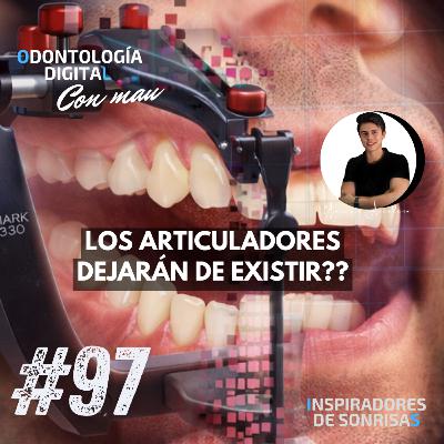 E97-Los articuladores dejarán de existir??