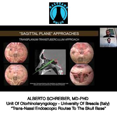 Trans-Nasal Endoscopic Routes To The Skull Base