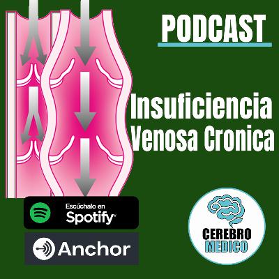 Insuficiencia Venosa Crónica Insuficiencia Venosa Crónica