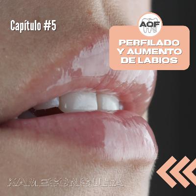 Capítulo 5: Perfilado y aumento de labios Capítulo 5: Perfilado y aumento de labios